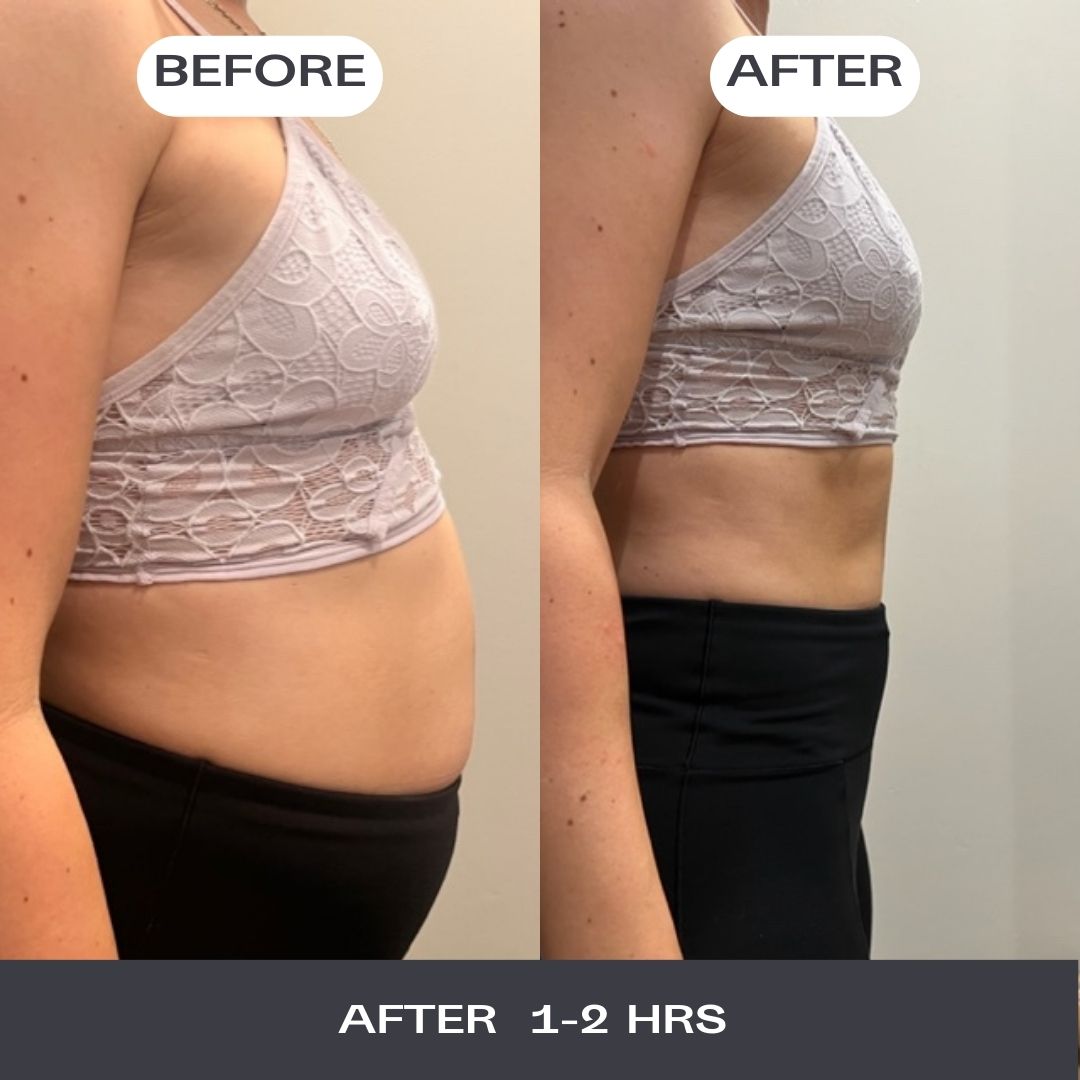 Wild Dose bloating supplement box with award badge.