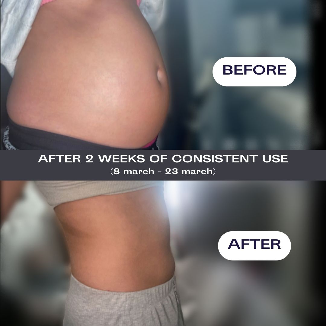 Wild Dose bloating supplement box with award badge.