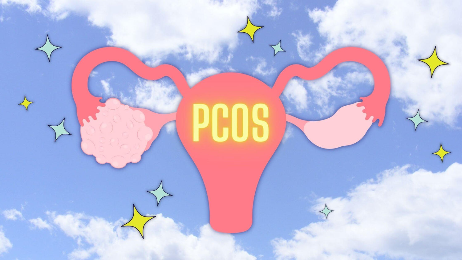 How To Stop PCOS Bloating