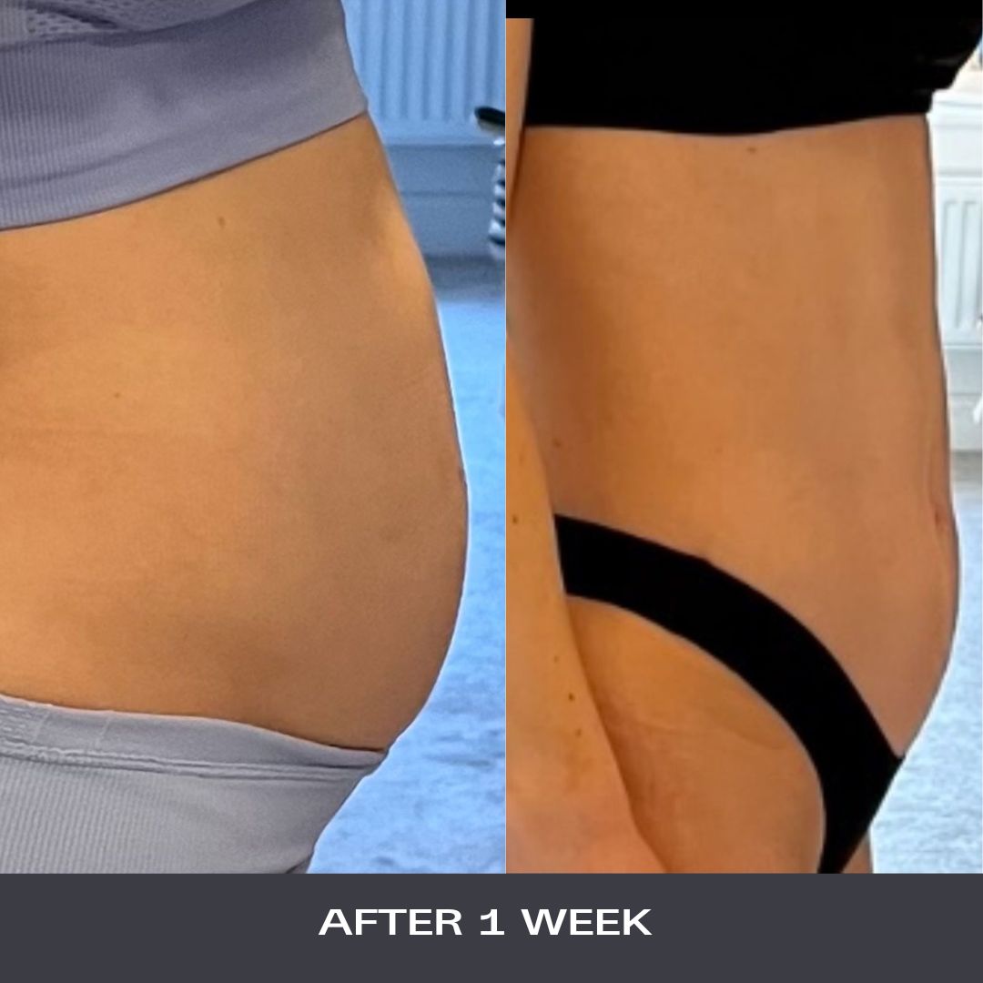 does wild dose work before and after images of bloating supplement